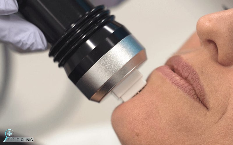 آر اف فرکشنال