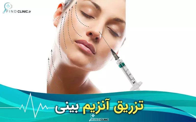 آنزیم هیالاز