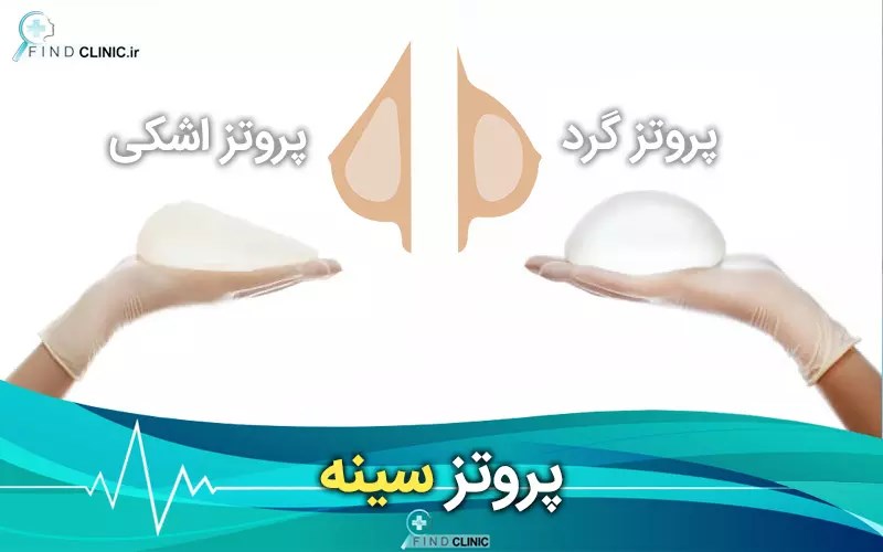 انواع پروتز سینه