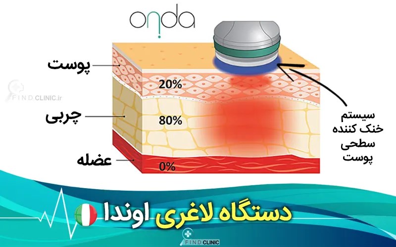 اوندا کول ویو