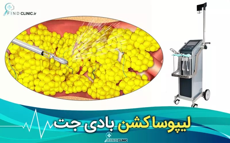 بهترین پزشک بادی جت