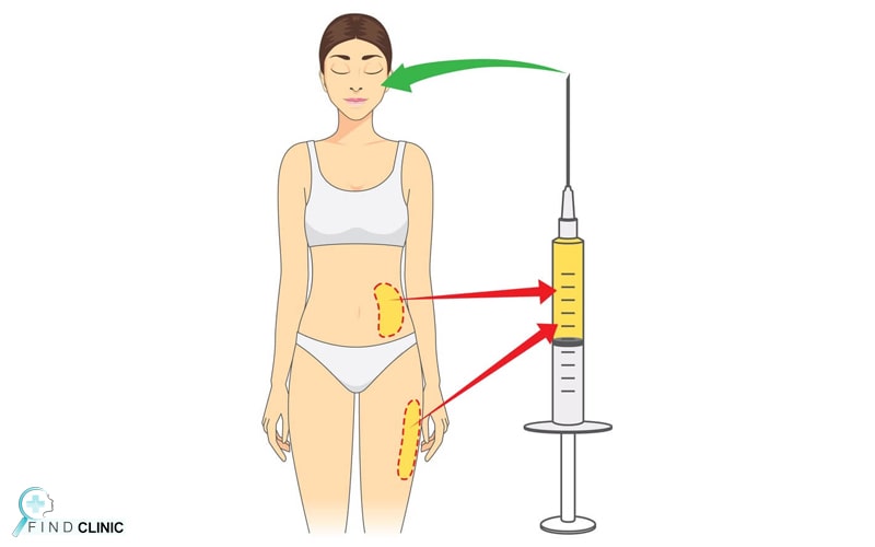 تزریق چربی چیست