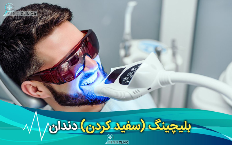 تفاوت بلیچینگ و لمینت دندان