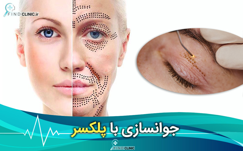 جوانسازی با پلکسر