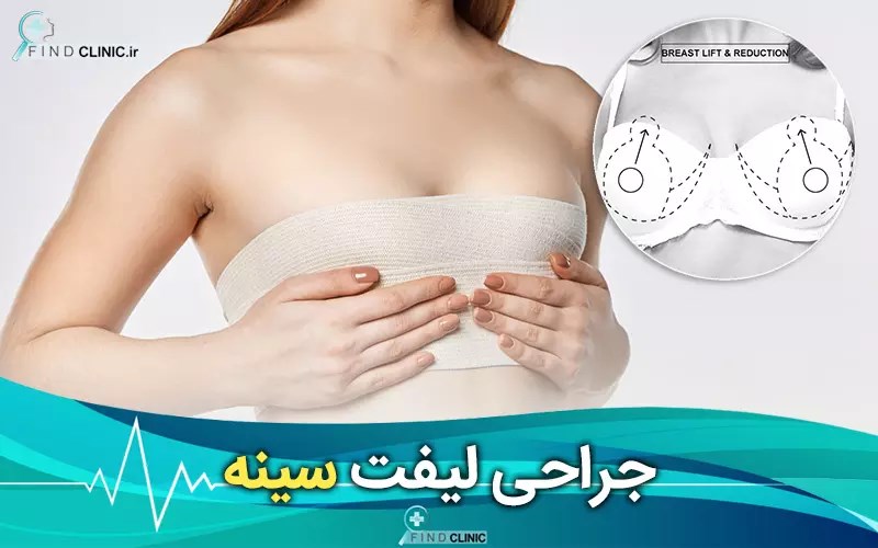 عمل لیفت سینه چیست