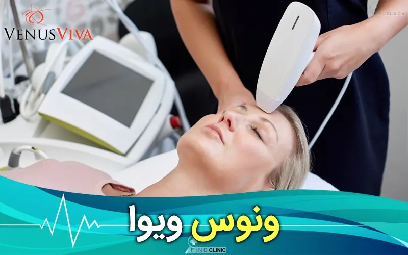 عملکرد ونوس ویوا