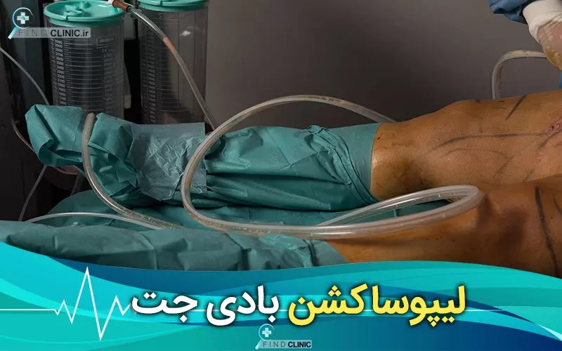 عوارض بادی جت