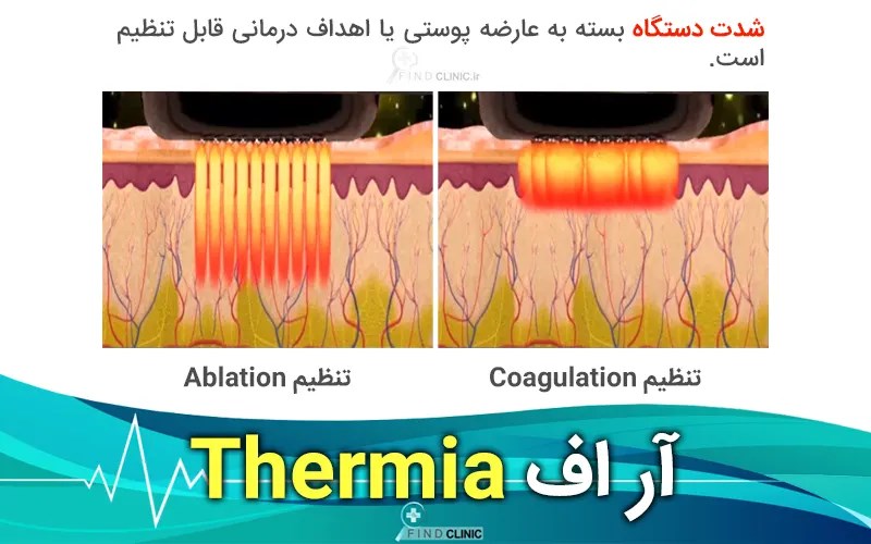 عوارض ترمیا