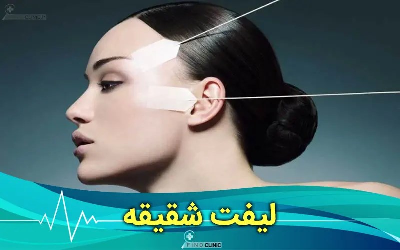 عوارض لیفت شقیقه