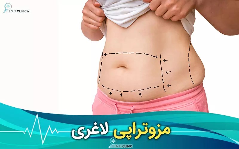 عوارض مزوترپی لاغری