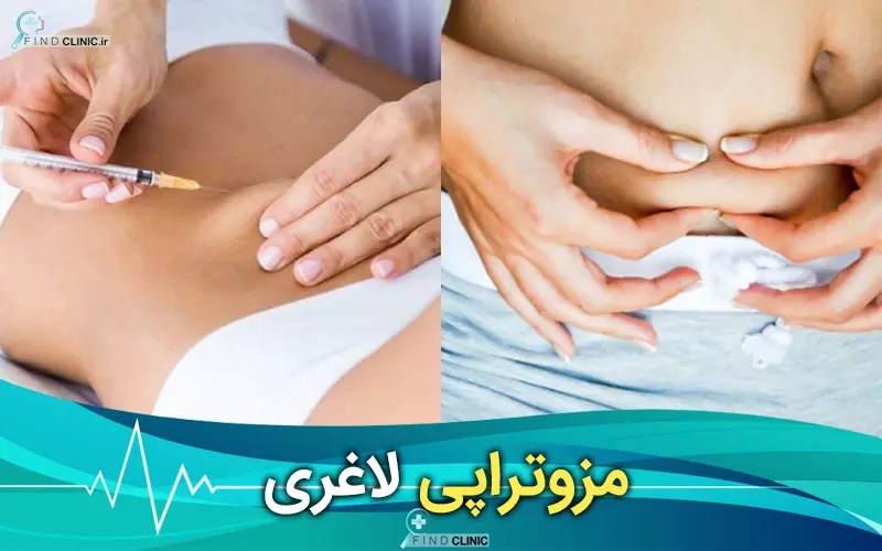 عکس مزوتراپی شکم