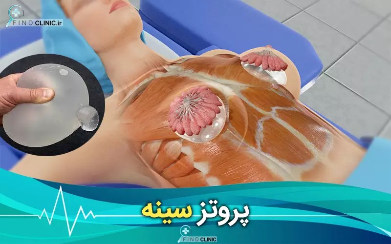 عکس پروتز سینه