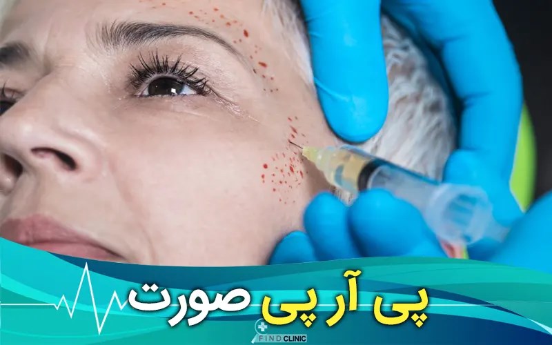 عکس پی آر پی صورت