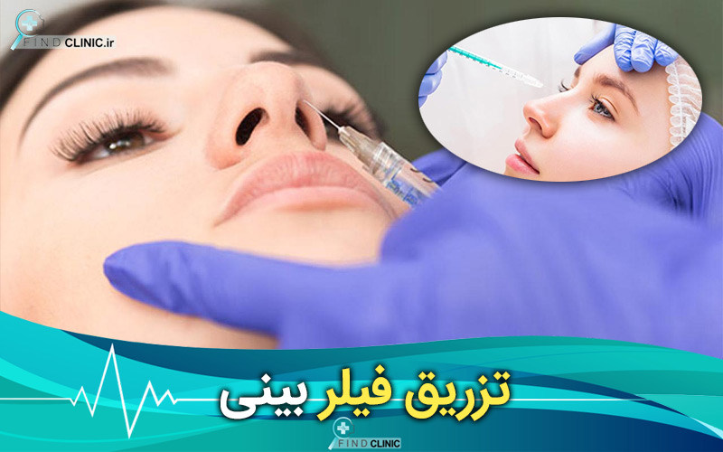 فیلر بینی چیست