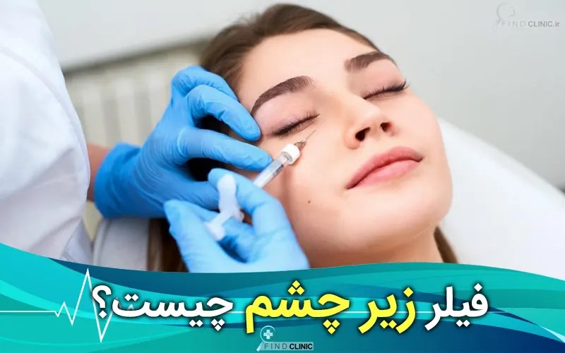 فیلر زیر چشم چیست