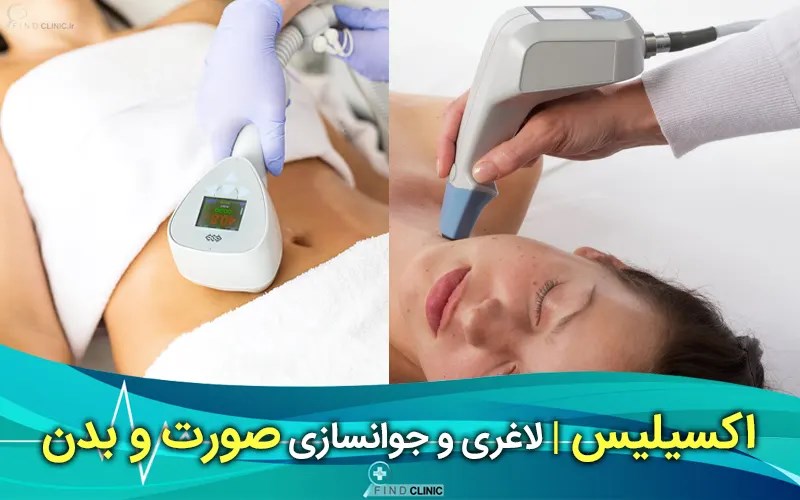 قیمت اکسیلیس