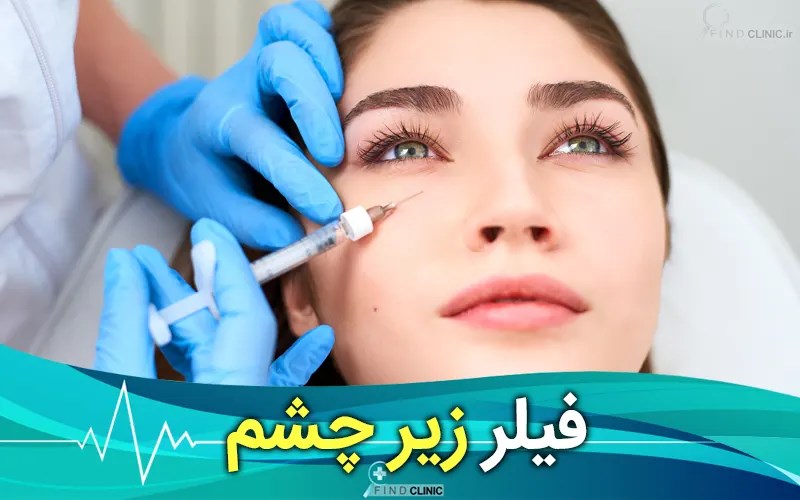قیمت فیلر زیر چشم