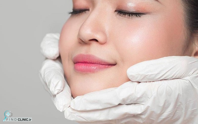 قیمت لیفت با نخ