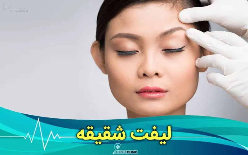قیمت لیفت شقیقه