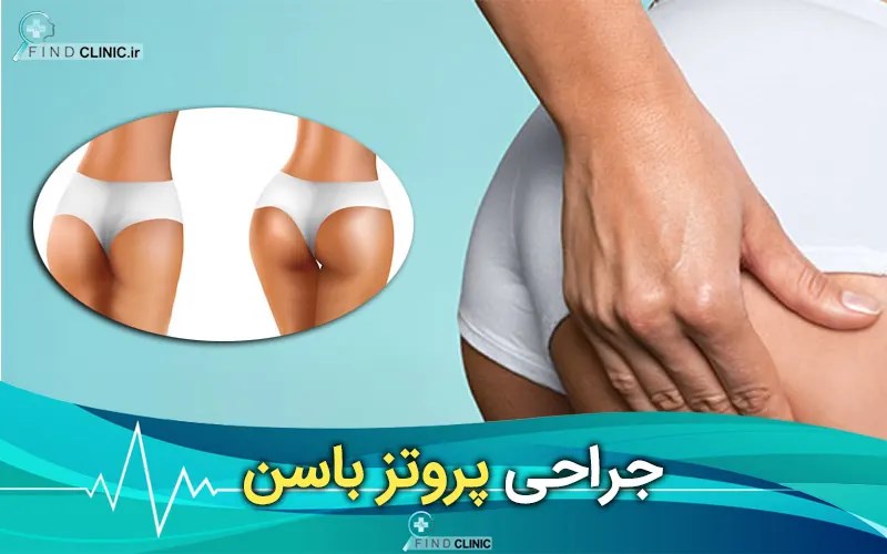 قیمت پروتز باسن