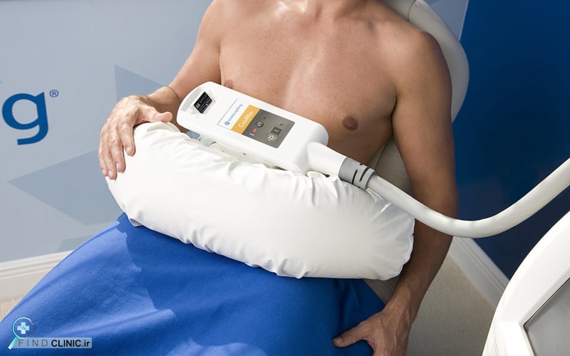 لاغری با کرایولیپولیز