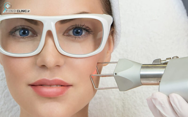 لیزر co2 فرکشنال فایند کلینیک