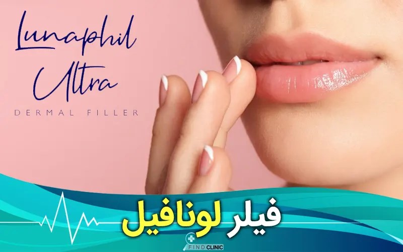 مدت ماندگاری ژل لونافیل