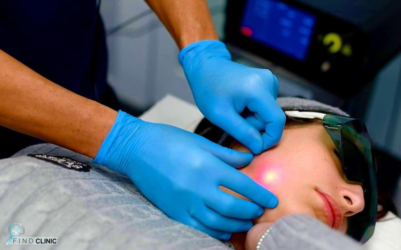 مراقبت های بعد از اندولیفت