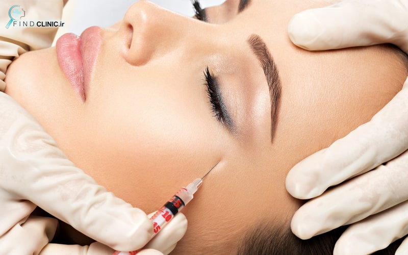 مراقبت های بعد از پروفایلو