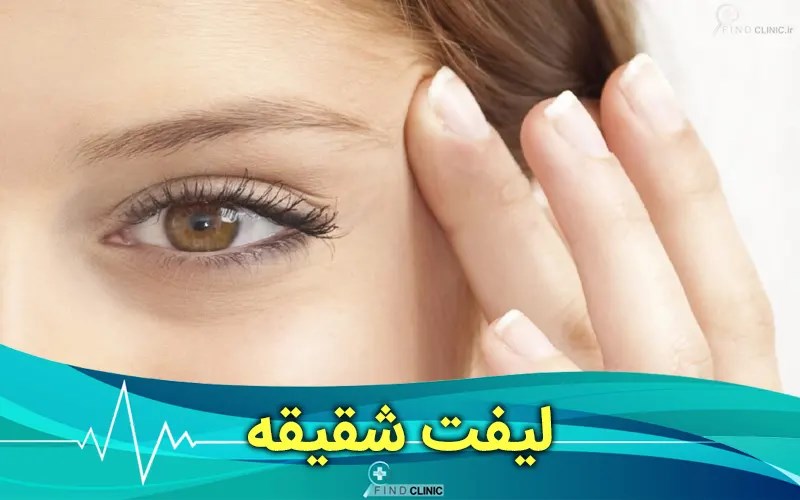نتایج لیفت شقیقه