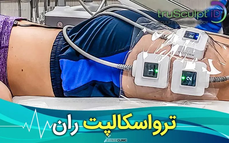 نواحی ترواسکالپ