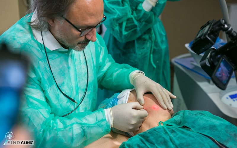 هزینه لیزر اندولیفت