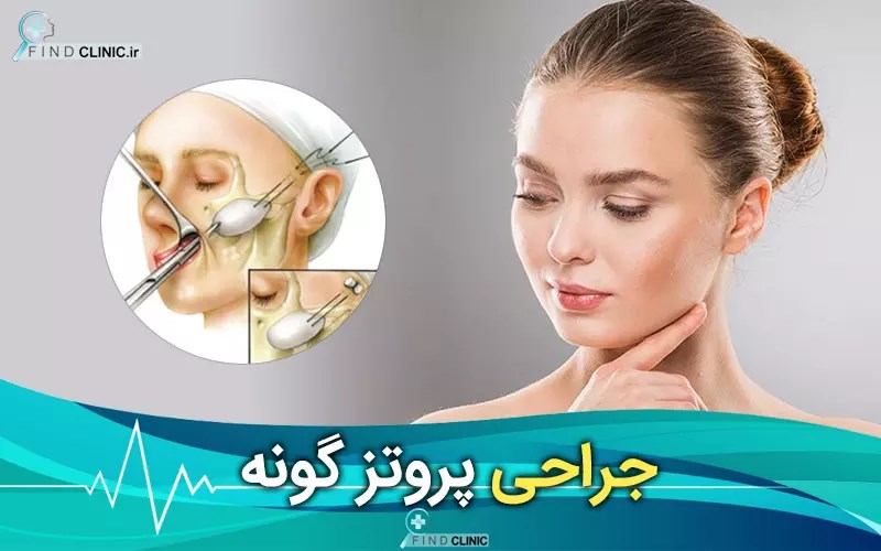 هزینه پروتز گونه