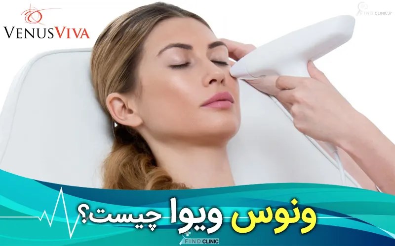 ونوس ویوا چیست