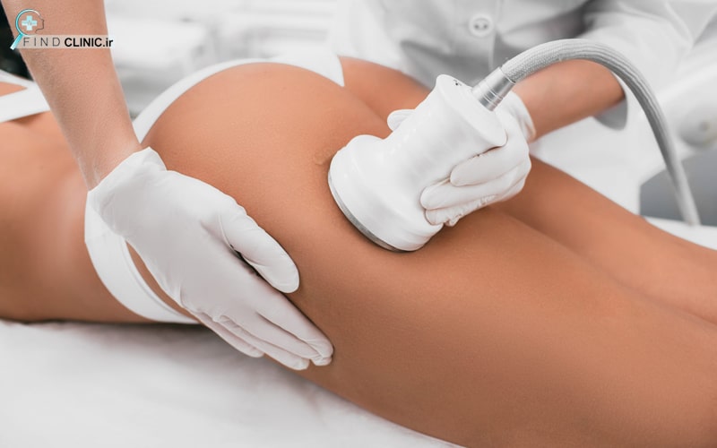 کویتیشن باسن